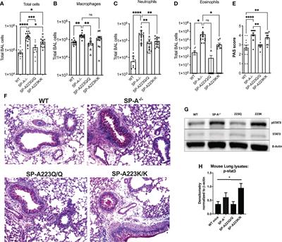 Small Peptide Derivatives Within the Carbohydrate Recognition Domain of SP-A2 Modulate Asthma Outcomes in Mouse Models and Human Cells